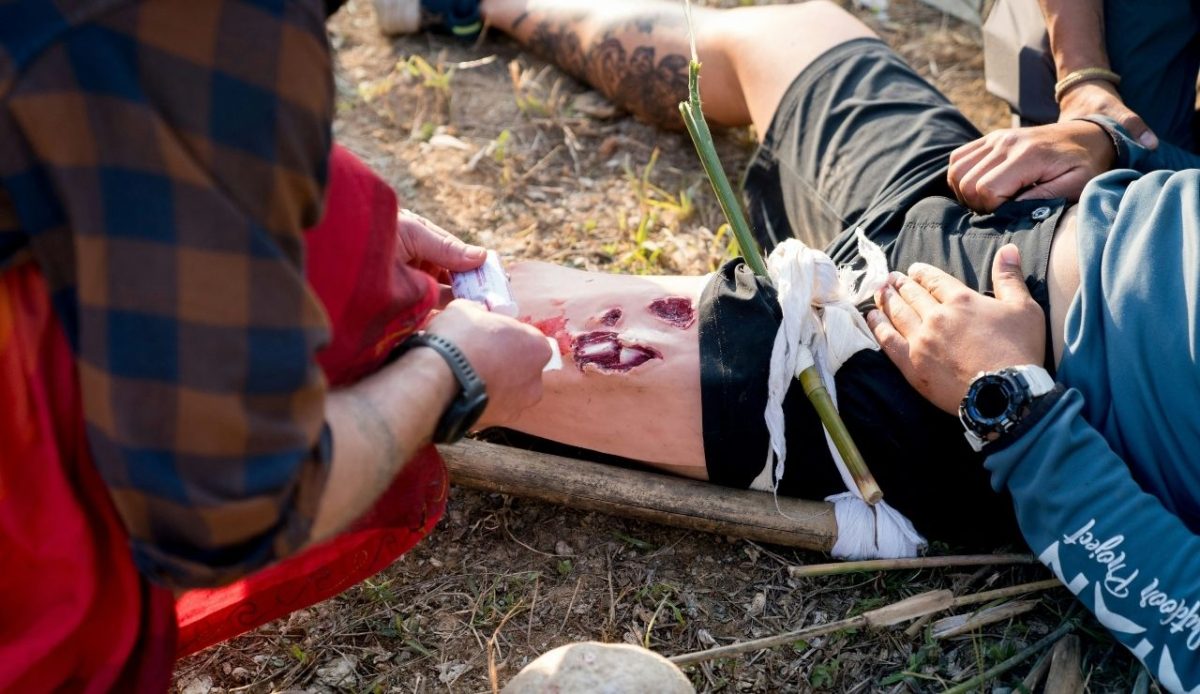 10 Essential Hiking Skills You Need Before Tackling Serious Trails 10 man is dressing laying man with broken leg